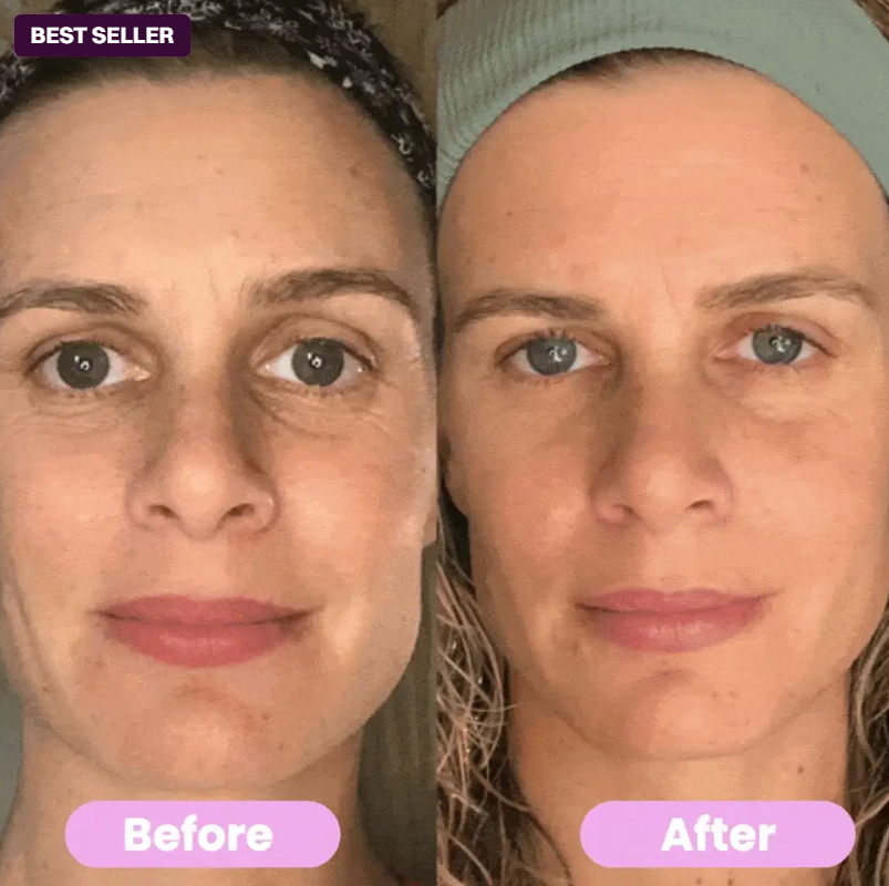 Norena™ 3-in-1 Sculptress